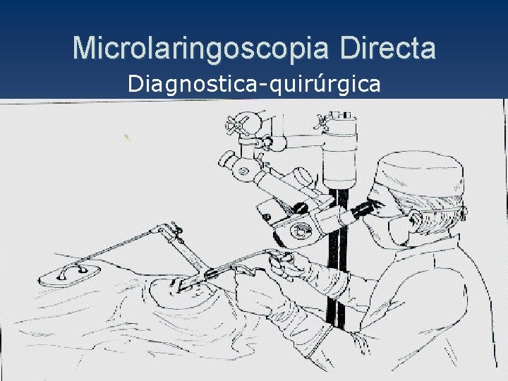 Microlaringoscopia Directa Diagnostica-quirúrgica 