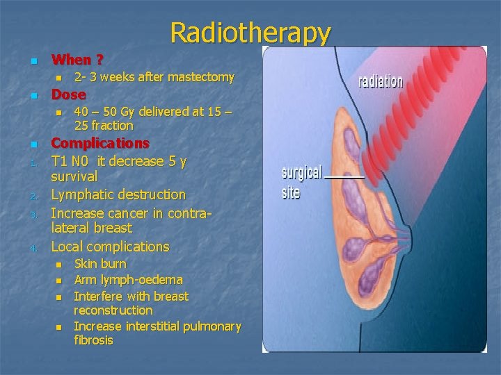 Radiotherapy n When ? n n Dose n n 1. 2. 3. 4. 2