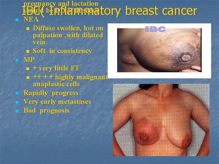 n n n pregnancy and lactation should be DD of abscess NEA n Diffuse