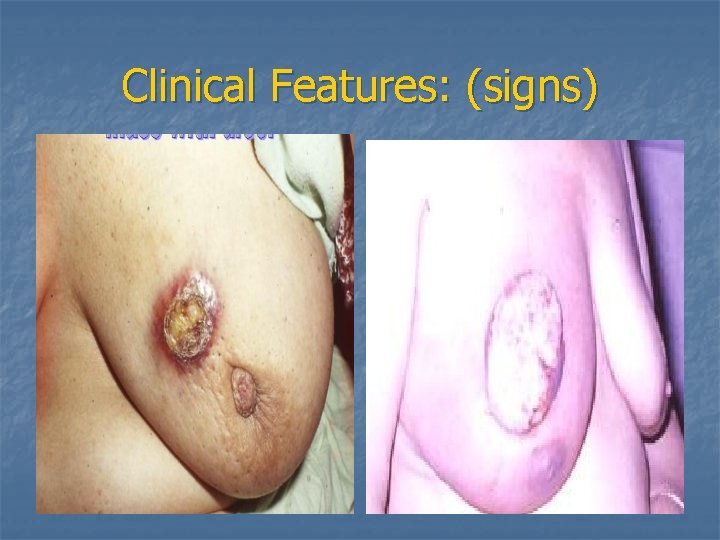 Clinical Features: (signs) 