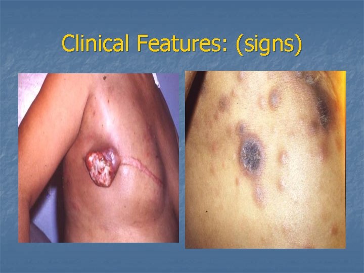 Clinical Features: (signs) 