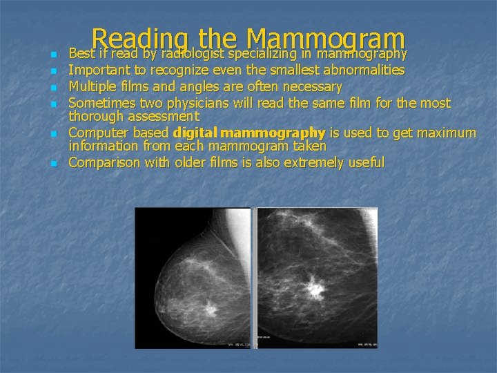 n n n Reading the Mammogram Best if read by radiologist specializing in mammography
