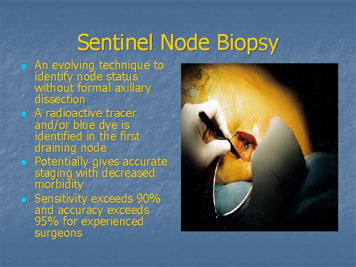 Sentinel Node Biopsy n n An evolving technique to identify node status without formal