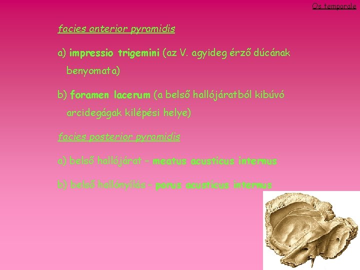 Os temporale facies anterior pyramidis a) impressio trigemini (az V. agyideg érző dúcának benyomata)