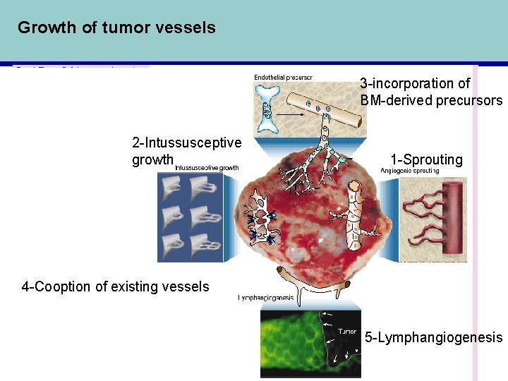 Growth of tumor vessels 3 -incorporation of BM-derived precursors 2 -Intussusceptive growth 1 -Sprouting