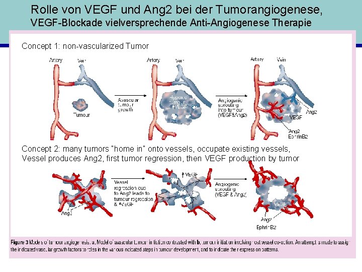 Rolle von VEGF und Ang 2 bei der Tumorangiogenese, VEGF-Blockade vielversprechende Anti-Angiogenese Therapie Concept