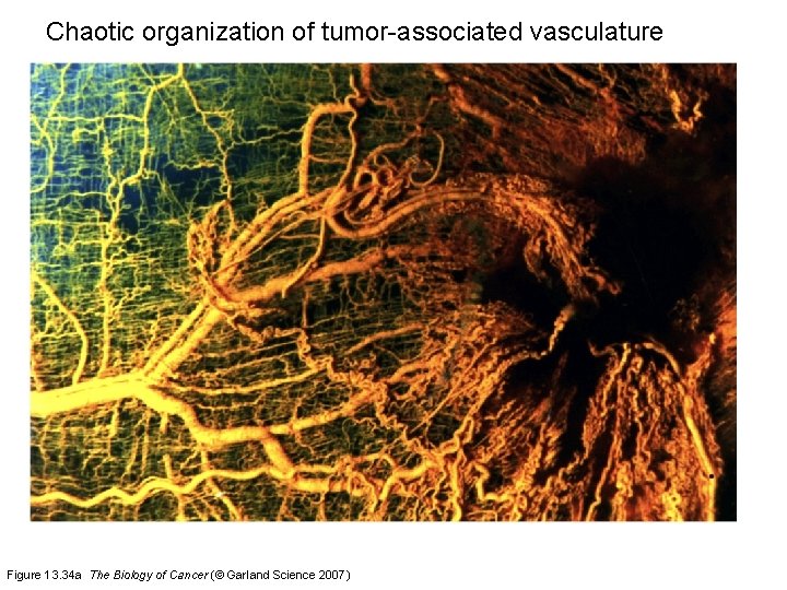 Chaotic organization of tumor-associated vasculature Figure 13. 34 a The Biology of Cancer (©