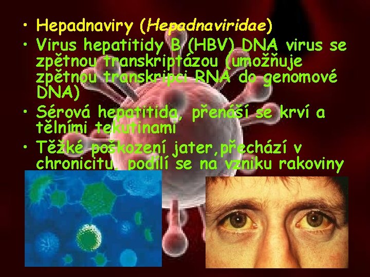  • Hepadnaviry (Hepadnaviridae) • Virus hepatitidy B (HBV) DNA virus se zpětnou transkriptázou