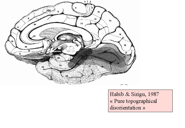 Habib & Sirigu, 1987 « Pure topographical disorientation » 