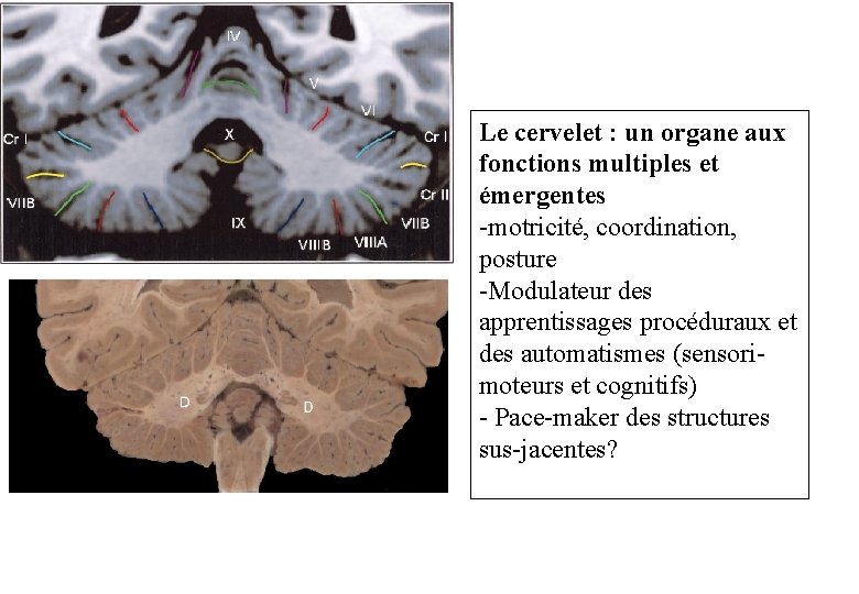 Le cervelet : un organe aux fonctions multiples et émergentes -motricité, coordination, posture -Modulateur