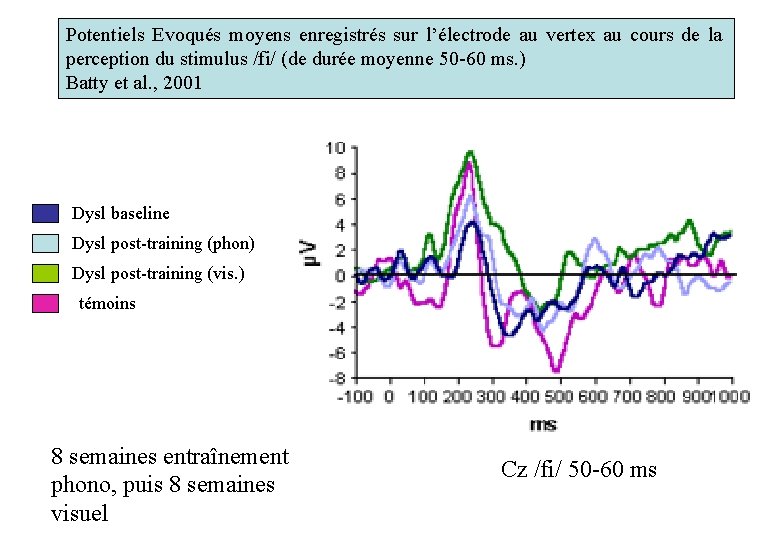 Potentiels Evoqués moyens enregistrés sur l’électrode au vertex au cours de la perception du