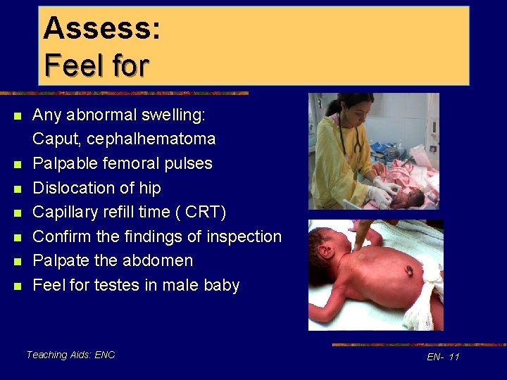 Assess: Feel for n n n n Any abnormal swelling: Caput, cephalhematoma Palpable femoral