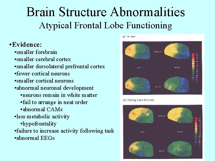 Brain Structure Abnormalities Atypical Frontal Lobe Functioning • Evidence: • smaller forebrain • smaller