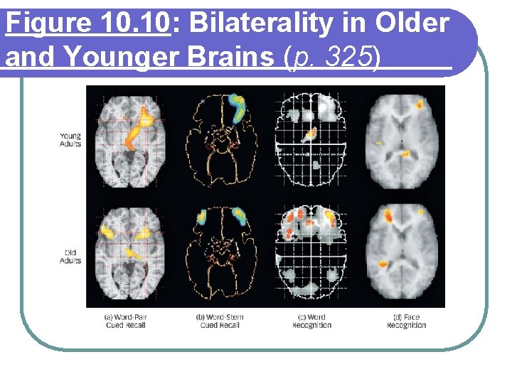 Figure 10. 10: Bilaterality in Older and Younger Brains (p. 325) 