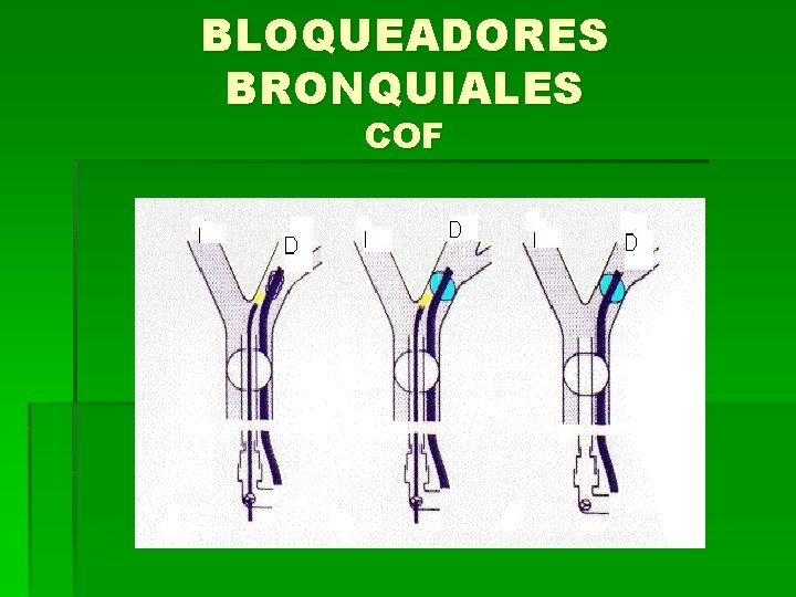 BLOQUEADORES BRONQUIALES COF 