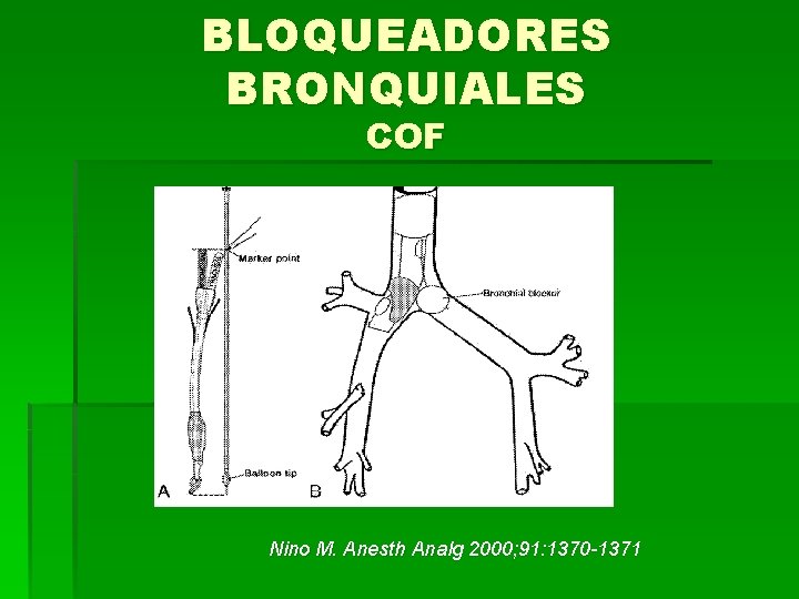 BLOQUEADORES BRONQUIALES COF Nino M. Anesth Analg 2000; 91: 1370 -1371 