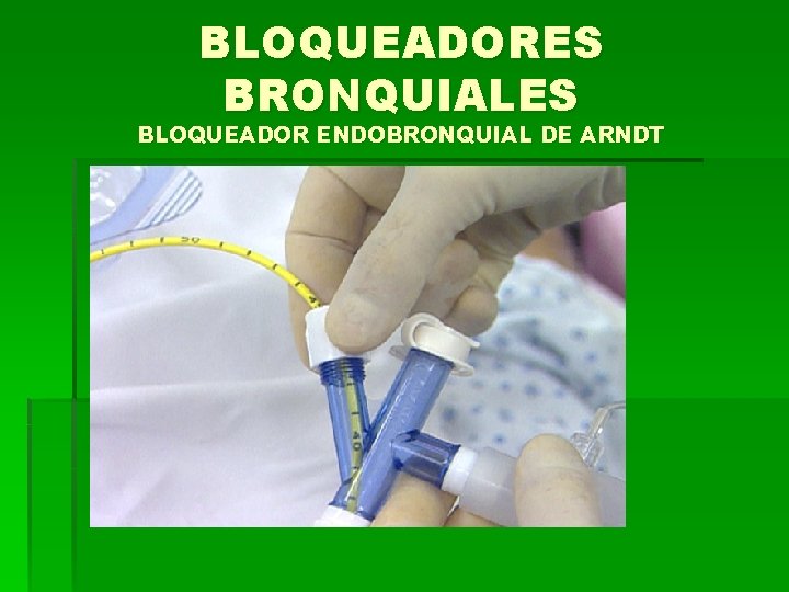 BLOQUEADORES BRONQUIALES BLOQUEADOR ENDOBRONQUIAL DE ARNDT 