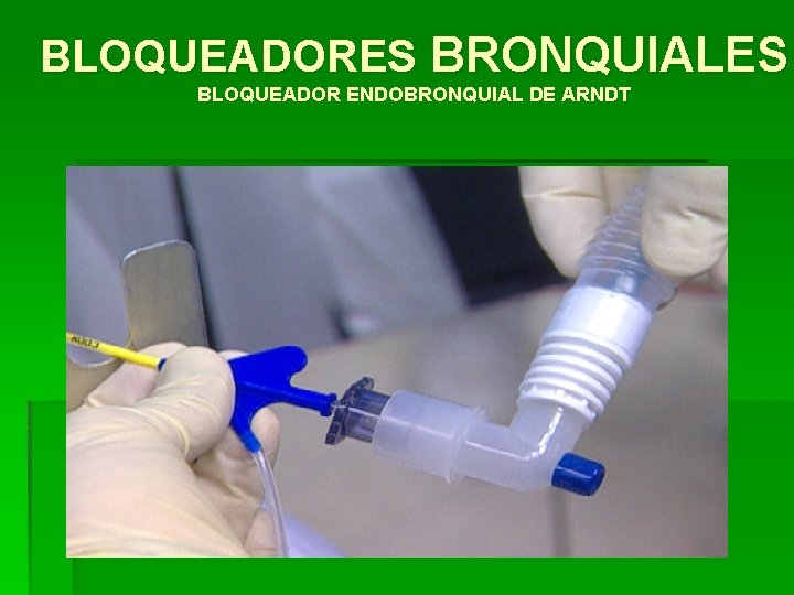 BLOQUEADORES BRONQUIALES BLOQUEADOR ENDOBRONQUIAL DE ARNDT 