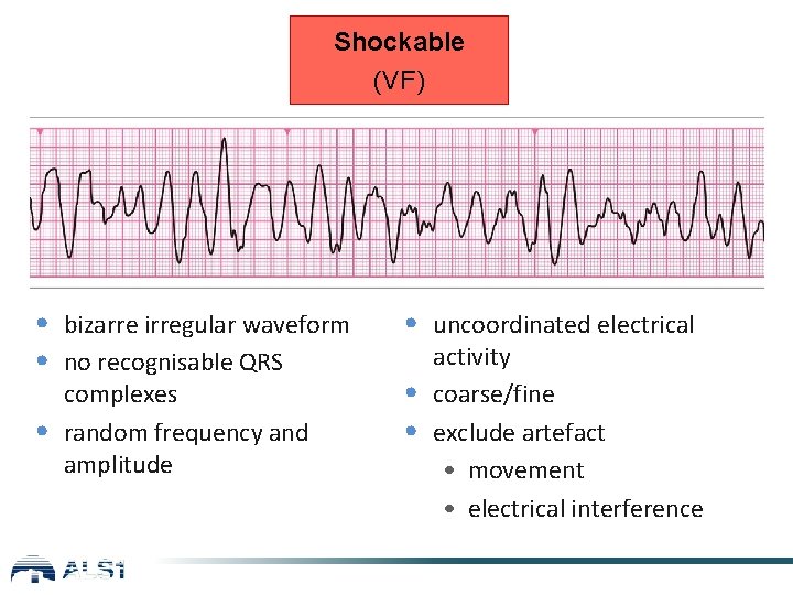 Shockable (VF) • bizarre irregular waveform • no recognisable QRS • complexes random frequency