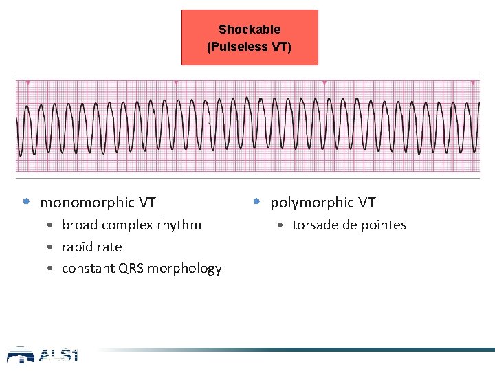 Shockable (Pulseless VT) • monomorphic VT • broad complex rhythm • rapid rate •