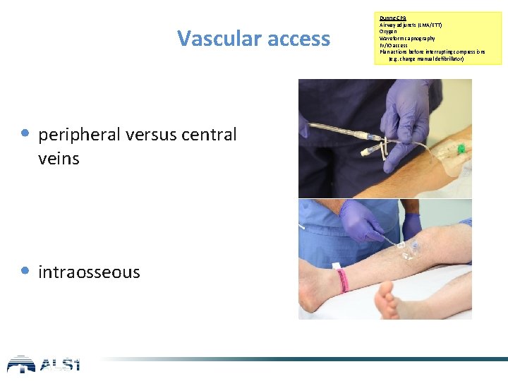 Vascular access • peripheral versus central veins • intraosseous During CPR Airway adjuncts (LMA/ETT)