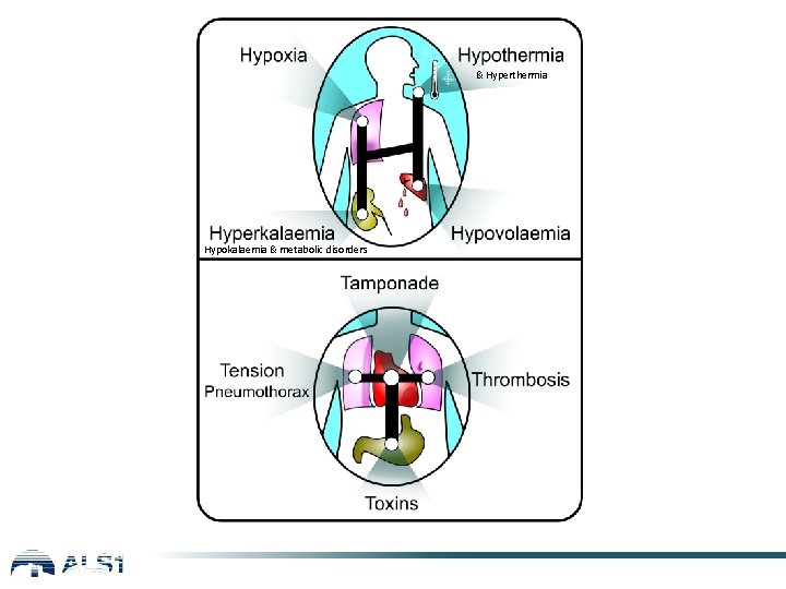 & Hyperthermia Hypokalaemia & metabolic disorders 