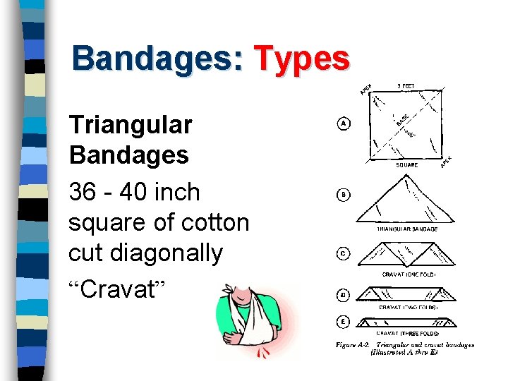 Bandages: Types Triangular Bandages 36 - 40 inch square of cotton cut diagonally “Cravat”