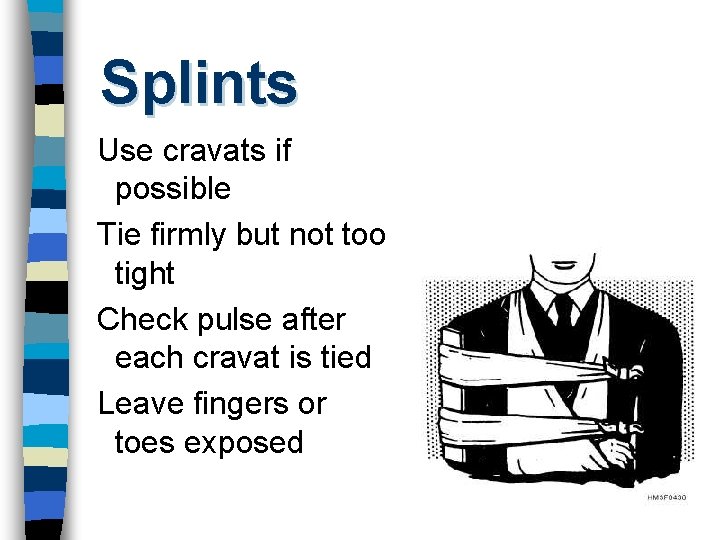 Splints Use cravats if possible Tie firmly but not too tight Check pulse after