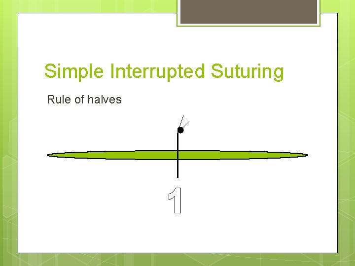 Simple Interrupted Suturing Rule of halves 