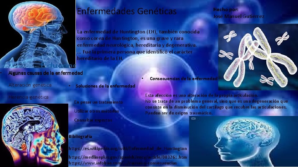  • Enfermedades Genéticas Hecho por: José Manuel Gutiérrez La enfermedad de Huntington (EH),