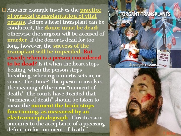 � Another example involves the practice of surgical transplantation of vital organs. Before a