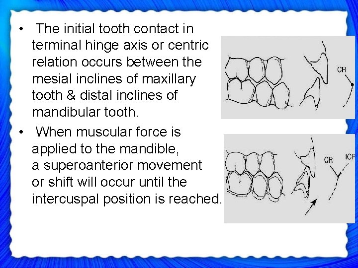  • The initial tooth contact in terminal hinge axis or centric relation occurs