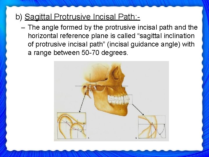  b) Sagittal Protrusive Incisal Path: – The angle formed by the protrusive incisal