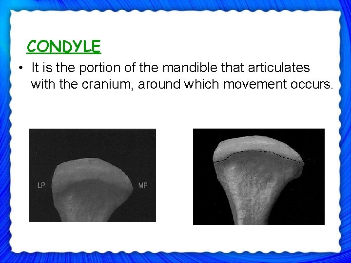  CONDYLE • It is the portion of the mandible that articulates with the