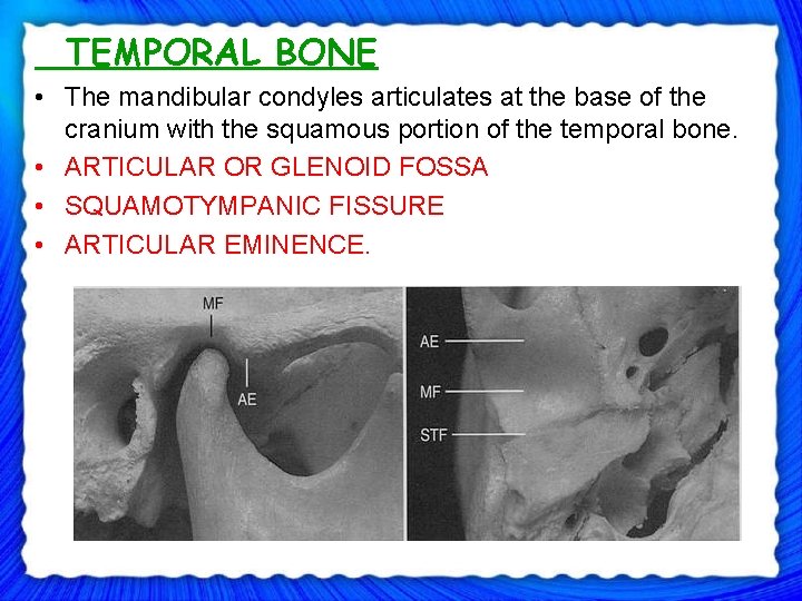 TEMPORAL BONE • The mandibular condyles articulates at the base of the cranium with