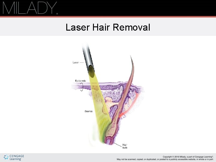 Laser Hair Removal 