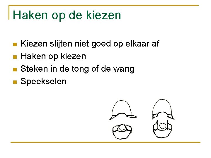 Haken op de kiezen n n Kiezen slijten niet goed op elkaar af Haken