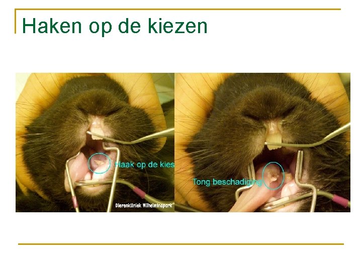 Haken op de kiezen 