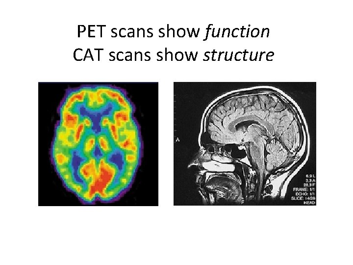 PET scans show function CAT scans show structure 