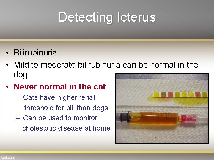 Detecting Icterus • Bilirubinuria • Mild to moderate bilirubinuria can be normal in the