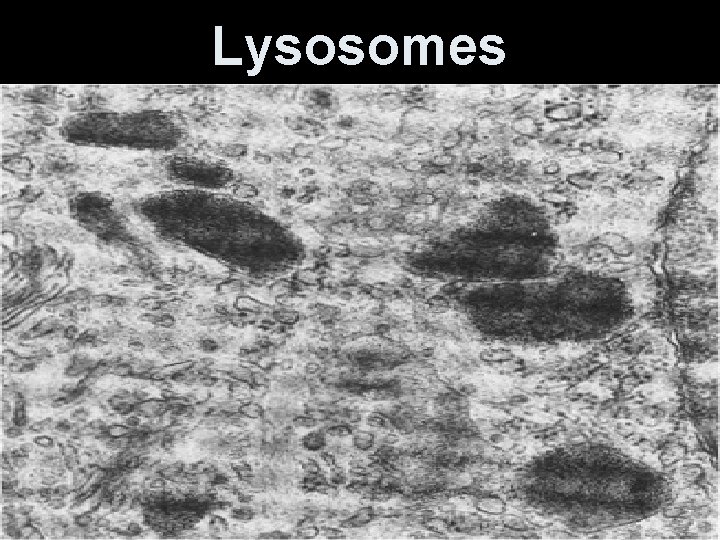 Lysosomes 
