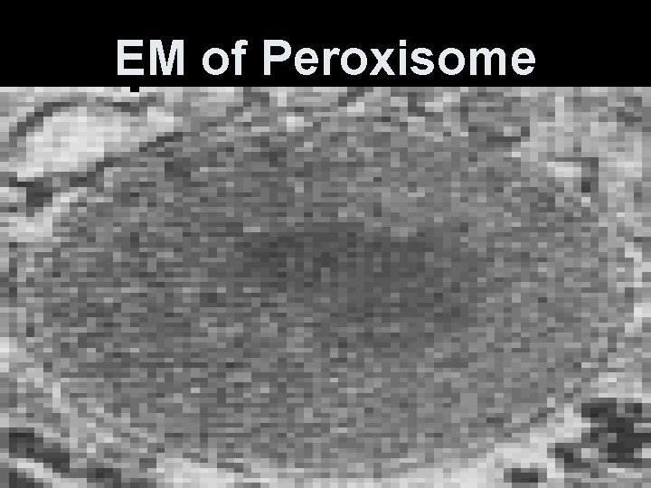 EM of Peroxisome 