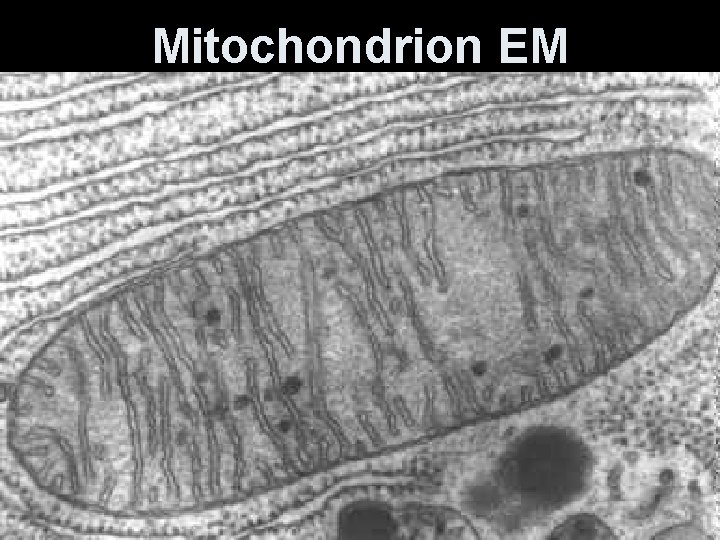 Mitochondrion EM 