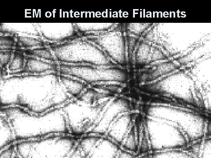 EM of Intermediate Filaments 