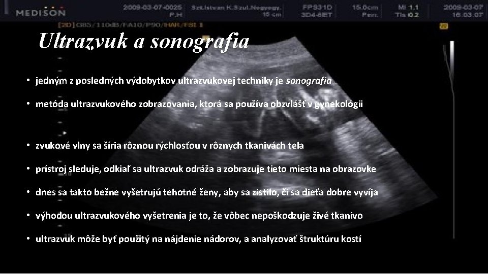 Ultrazvuk a sonografia • jedným z posledných výdobytkov ultrazvukovej techniky je sonografia • metóda