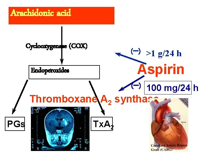 Arachidonic acid Cyclooxygenase (COX) (-) >1 g/24 h Aspirin Endoperoxides (-) 100 mg/24 h