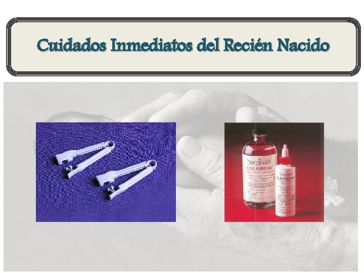 Cuidados Inmediatos del Recién Nacido 