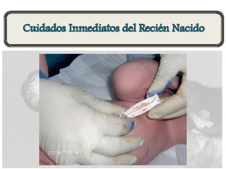 Cuidados Inmediatos del Recién Nacido 