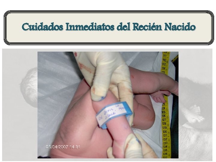 Cuidados Inmediatos del Recién Nacido 