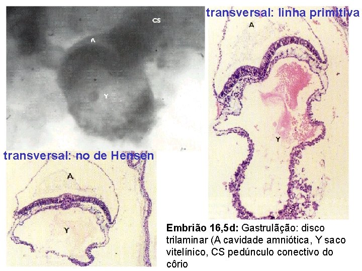 transversal: linha primitiva transversal: no de Hensen Embrião 16, 5 d: Gastrulãção: disco trilaminar
